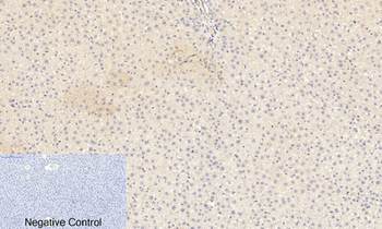 JAK2 (phospho Tyr1007) Polyclonal Antibody