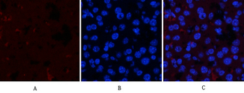 JAK1 (phospho Tyr1022) Polyclonal Antibody
