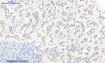 IκB-α (phospho Ser32/S36) Polyclonal Antibody