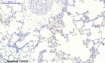 IκB-α (phospho Ser32/S36) Polyclonal Antibody