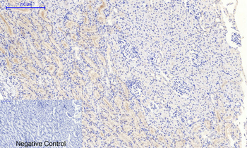 IκB-α (phospho Ser32/S36) Polyclonal Antibody