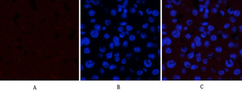 GSK3α/β (phospho Tyr279/216) Polyclonal Antibody