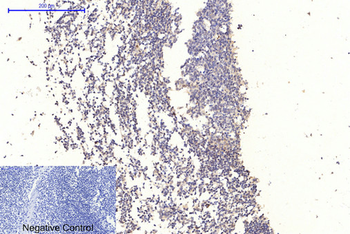 GSK3α/β (phospho Tyr279/216) Polyclonal Antibody