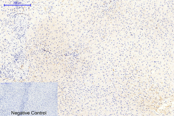 GSK3α/β (phospho Tyr279/216) Polyclonal Antibody
