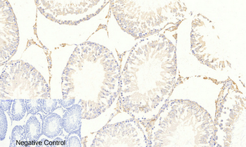 FoxO3A (phospho Ser253) Polyclonal Antibody