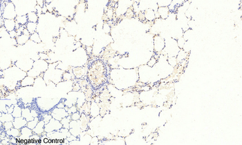 FoxO3A (phospho Ser253) Polyclonal Antibody