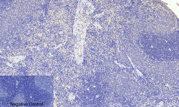 FoxO3A (phospho Ser253) Polyclonal Antibody