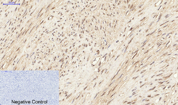 ERK 1/2 (phospho Tyr204) Polyclonal Antibody
