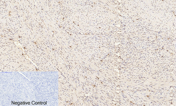 ERK 1/2 (phospho Thr202) Polyclonal Antibody