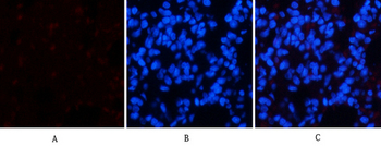 Chk2 (phospho Thr68) Polyclonal Antibody