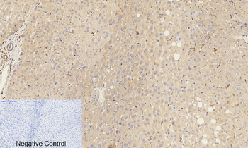Catenin-β (phospho Ser37) Polyclonal Antibody