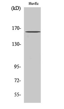 Bcr (phospho Tyr177) Polyclonal Antibody