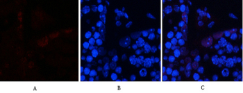 AP-1 (phospho Ser63) Polyclonal Antibody