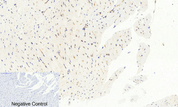 AP-1 (phospho Ser63) Polyclonal Antibody