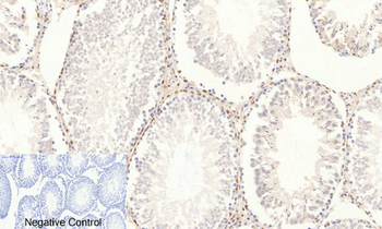 AP-1 (phospho Ser63) Polyclonal Antibody