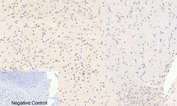 AP-1 (phospho Ser63) Polyclonal Antibody