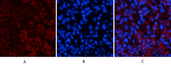 ATG7 mouse Monoclonal Antibody(3D6)