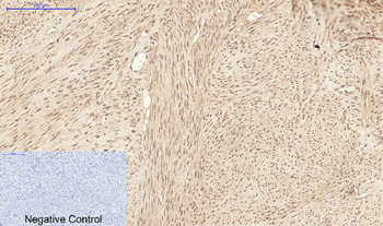 ATG7 mouse Monoclonal Antibody(3D6)