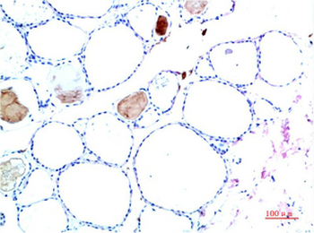 TTR mouse Monoclonal Antibody(10H2)