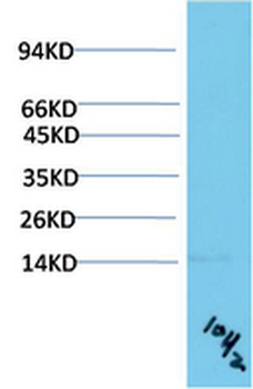 TTR mouse Monoclonal Antibody(10H2)