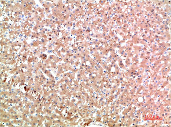 TTR mouse Monoclonal Antibody(6E5)