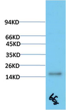 TTR mouse Monoclonal Antibody(6E5)