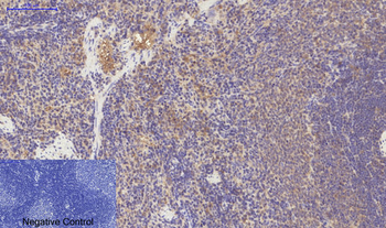 PDGFRα mouse Monoclonal Antibody(7A3)