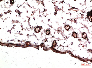 PDGFRα mouse Monoclonal Antibody(7A3)