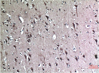 Beclin-1 mouse Monoclonal Antibody(5C5)