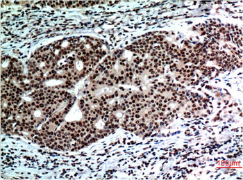 Beclin-1 mouse Monoclonal Antibody(5C5)