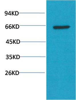 AKT mouse Monoclonal Antibody(10D6)