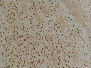 Kv10.1 Polyclonal Antibody