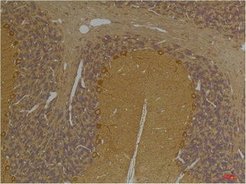 SLC12A4 Polyclonal Antibody