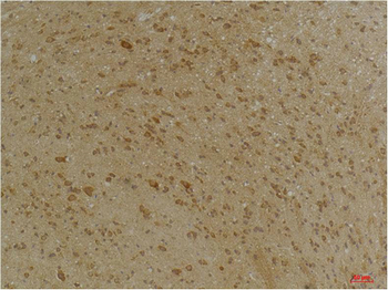 SLC12A4 Polyclonal Antibody