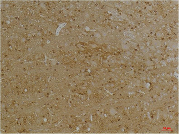 Kv1.1 potassium channel Polyclonal Antibody