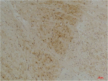 Kv1.1 potassium channel Polyclonal Antibody