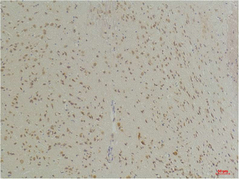 GABA Transporter 1 Polyclonal Antibody