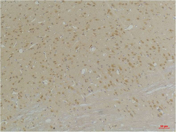 GABA A Receptor α4 Polyclonal Antibody
