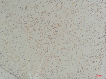 Connexin-26 Polyclonal Antibody