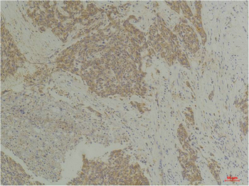 CLIC4 Polyclonal Antibody