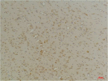 CLIC4 Polyclonal Antibody