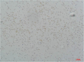 Cav3.2 Polyclonal Antibody