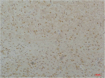Cav3.2 Polyclonal Antibody