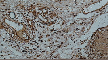 Galectin-3 Monoclonal Antibody(8D7)