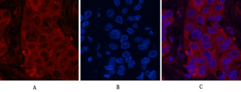 α-tubulin (Acetyl Lys40) Monoclonal Antibody(4A8)