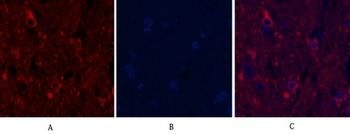 α-tubulin (Acetyl Lys40) Monoclonal Antibody(4A8)
