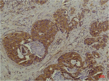 P44/42 MAPK (ERK1/2) Monoclonal Antibody(6C10)