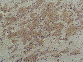 P44/42 MAPK (ERK1/2) Monoclonal Antibody(6B1)