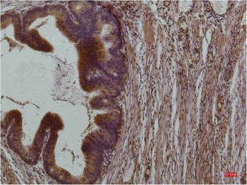 STAT3 Monoclonal Antibody(3F4)
