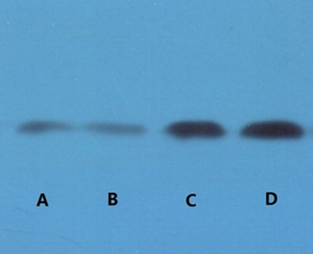 STAT3 Monoclonal Antibody(3F4)